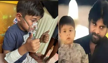 పవన్ కళ్యాణ్ కుమారుడి హెల్త్ అప్డేట్