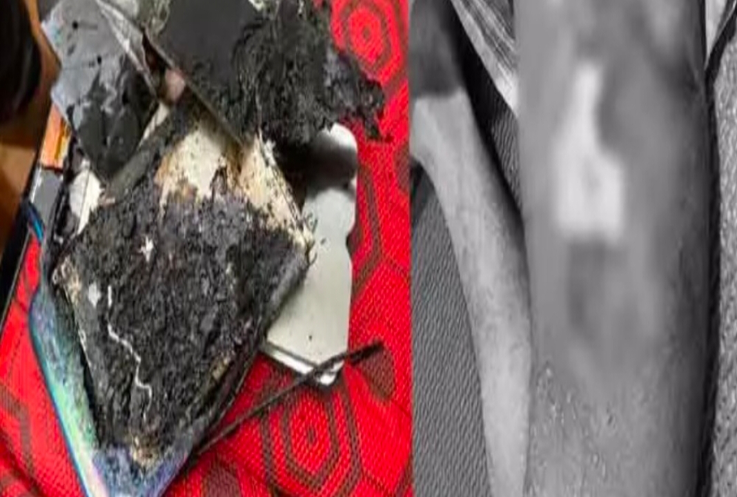 యువకుడి ప్యాంట్ జేబులో పేలిపోయిన మొబైల్