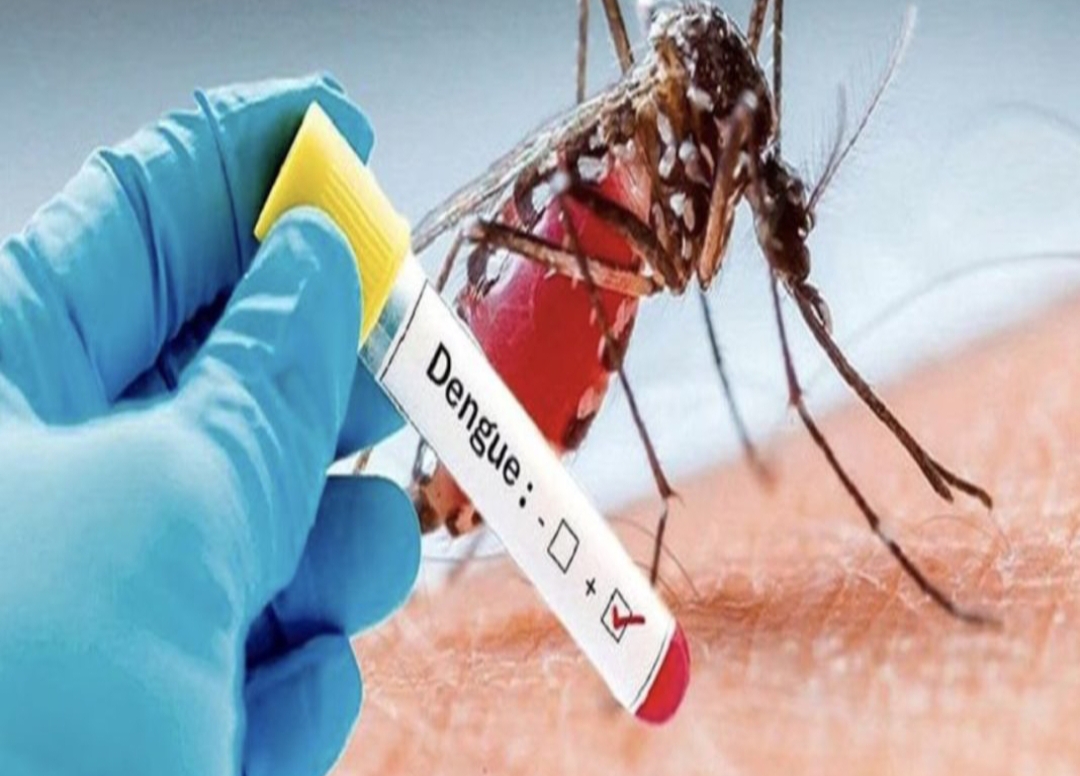 డెంగ్యూ లక్షణాలు ఇవే..