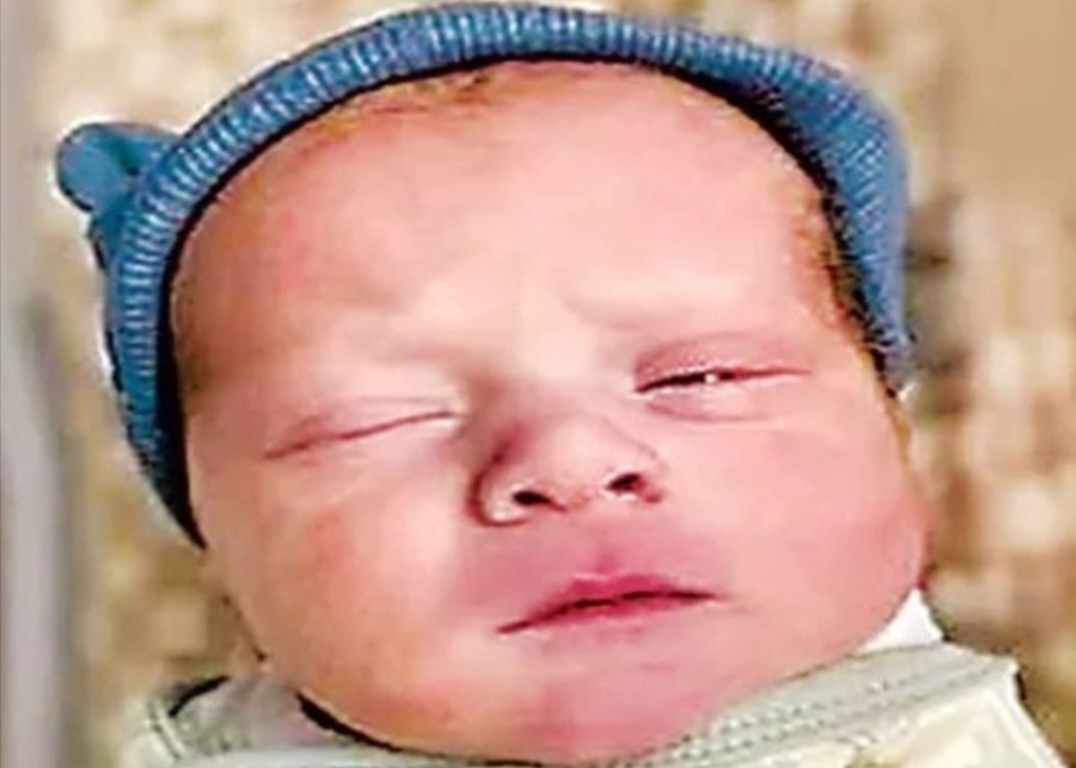 30 ఏళ్లు పిండంగానే... ఇప్పుడు శిశువుగా..