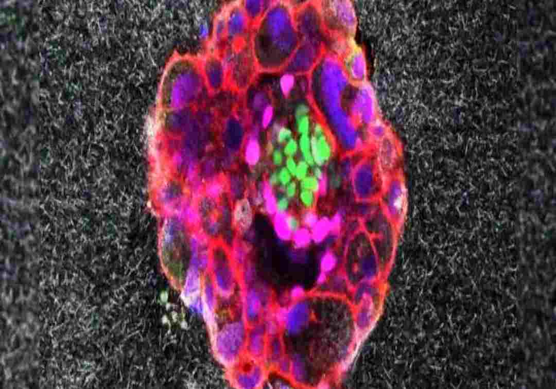 వైద్యరంగంలో మరో అద్భుతం