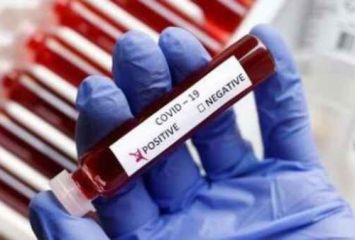 కరోనా వైరస్ టెస్ట్ కిట్స్,  మేడిన్ ఏపీ, భారీగా కమర్షియల్ ఆర్డర్లు