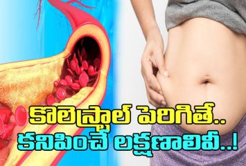 కొలెస్ట్రాల్ పెరిగితే కనిపించే  లక్షణాలు ఇవే..